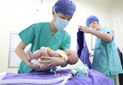 顺义妇儿医院完成首例超低龄小婴儿全麻手术
